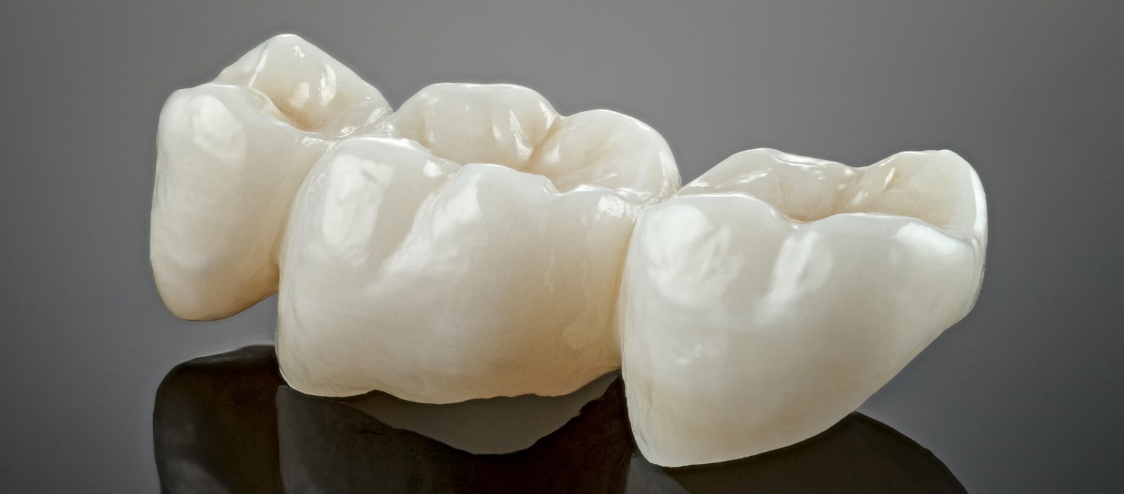 Full Zirconia Crown